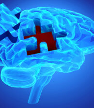 Memory Loss: Remember...to Plan