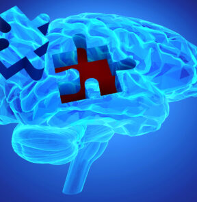 Memory Loss: Remember...to Plan